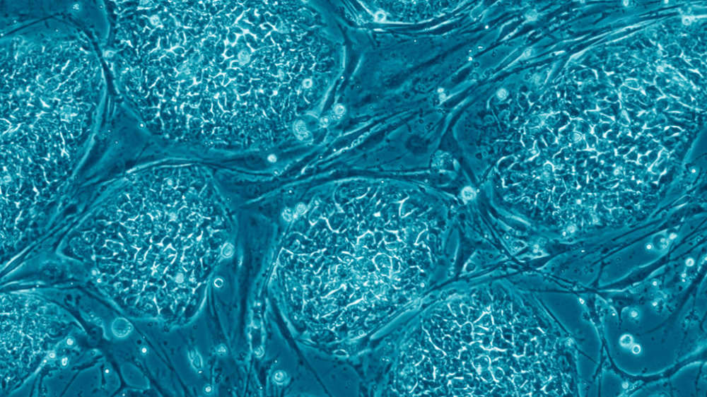 Human Embryonic Stem Cells (by Nissim Benvenisty via Wikimedia Commons)
