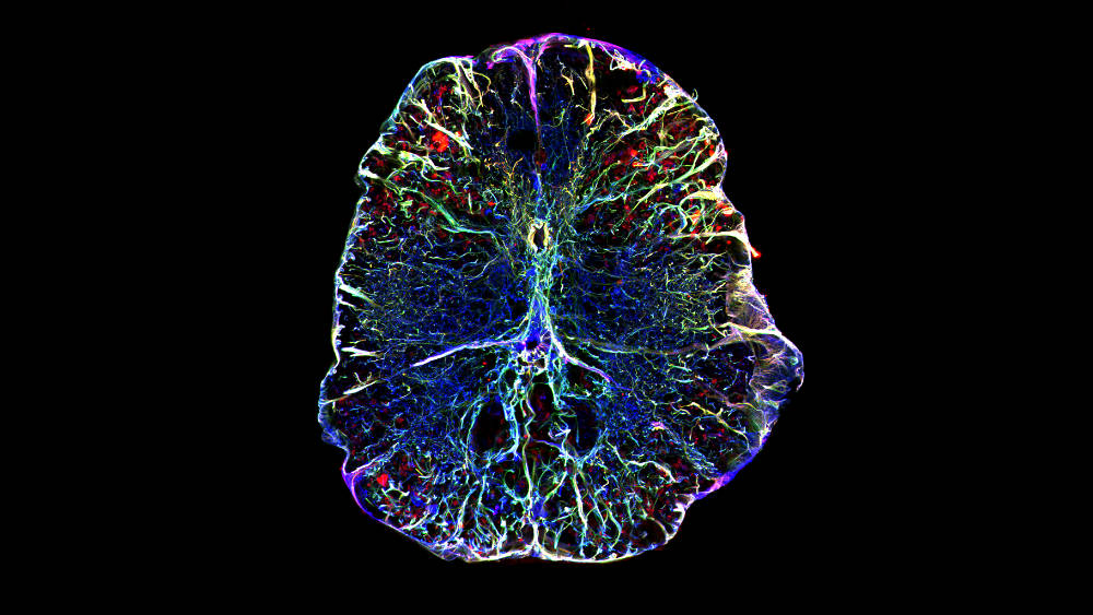 Cross section of the zebrafish spinal cord (microscopy image)