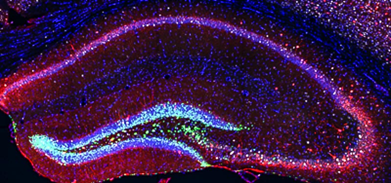 Image of neural stem cells and newborn neurons artificially generated in the hippocampus and contacting mature cells of the mouse brain