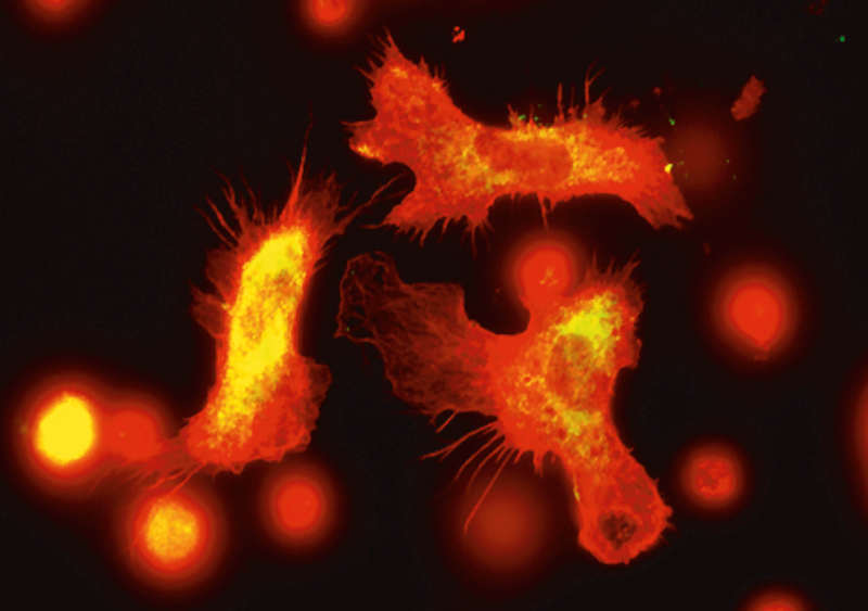 Immune cells by fluorescence microscopy