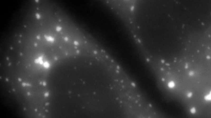 Video still taken from a Fluorescence Time-Lapse Video of HeLa Cells Expressing G3BP1-mCherry