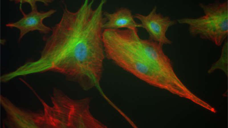 Green microtubules and red actin